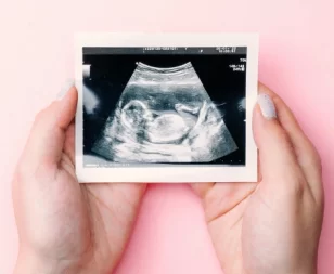Ultrasound photo of a successful pregnancy.